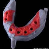 博瑞展牙龈3D打印光敏树脂红色柔性软料