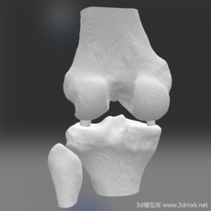 膝盖骨骼3d打印模型下载
