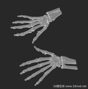 手骨医疗 3D 模型